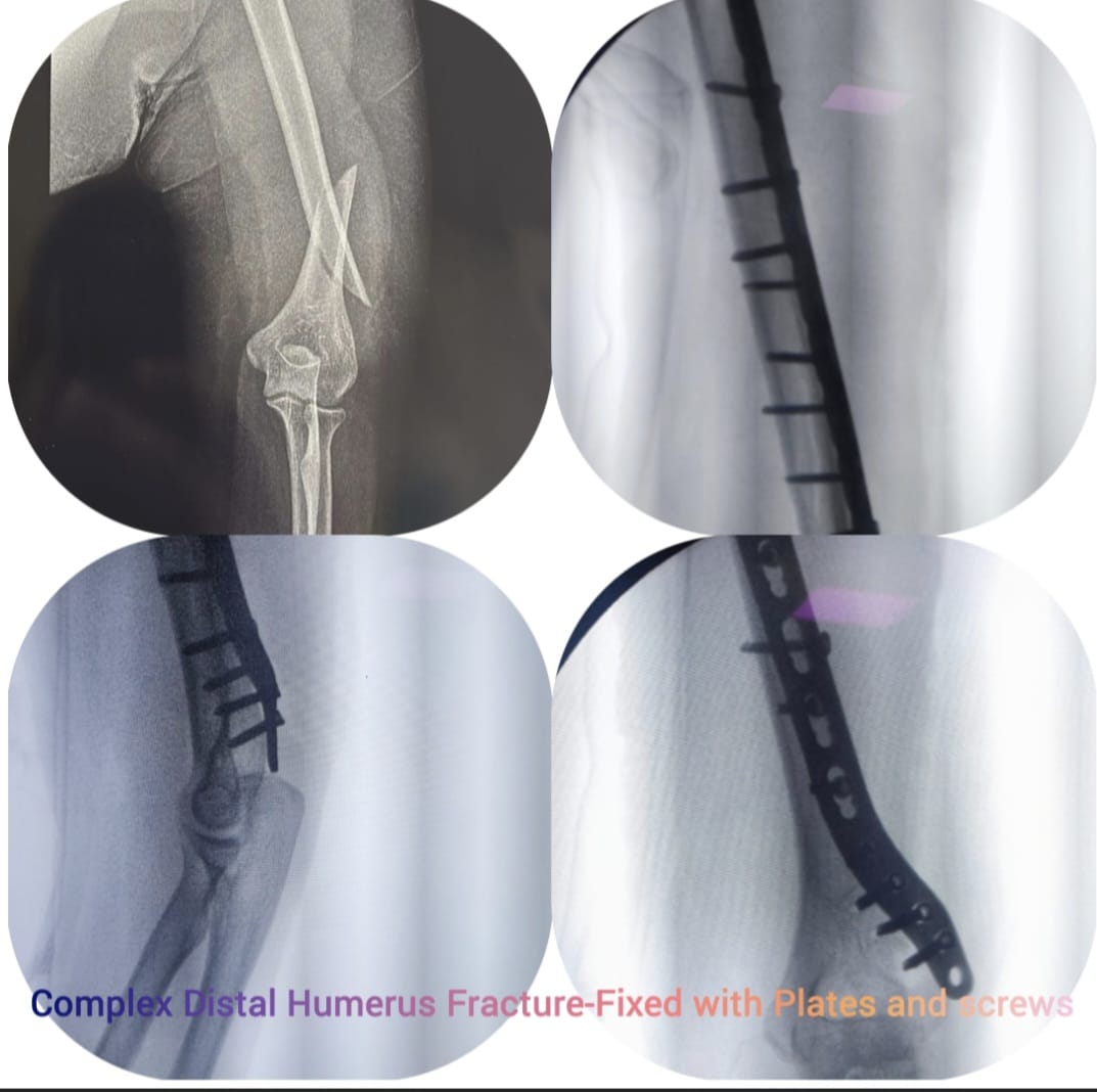 Knee X-ray 7